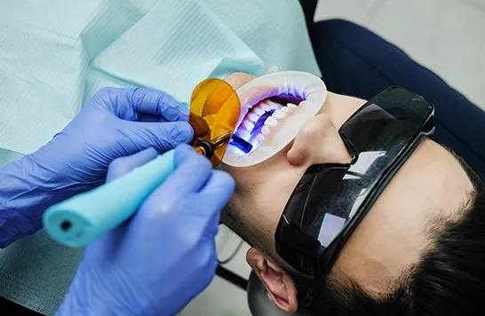 Orthodontic Extractions